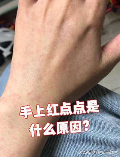 qq没消息但有红点,且没法消除