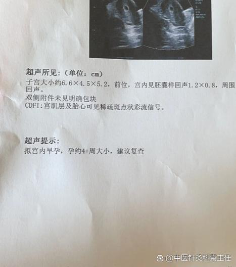 1d是多少天