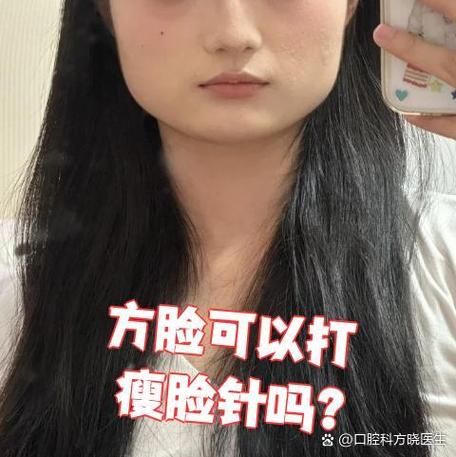 打脸可以瘦脸吗